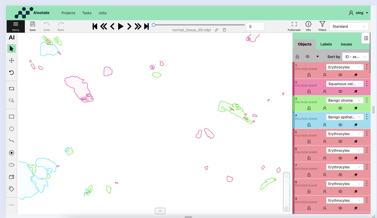 Ainnotate — interactive image annotation platform with polygon shapes and classification labels
